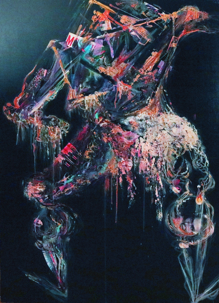 Autoerotic death