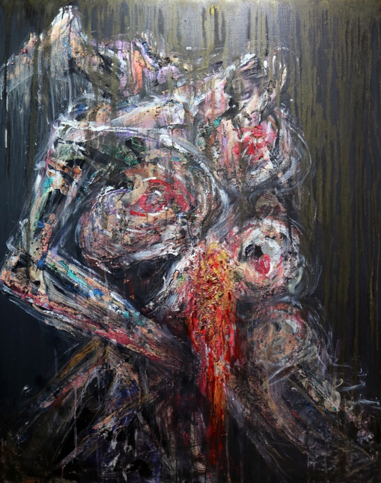 Autoerotic death